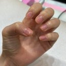 정스케어