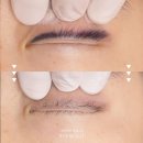 Hi,댕댕 | 아이라인 문신제거 3회차 전후 후기ㅣ창원 제시뷰티 마산(통증,붓기)