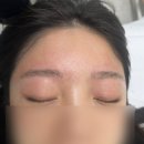 국민은행 상주지점(2층) | 시흥 정왕동 눈썹문신 제거, 미작뷰티 시흥점 대만족 솔직후기