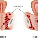 람세스피부관리