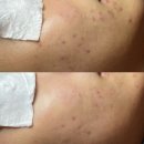 롯데마트여수점LG화장품 | 여수여드름관리 이유샵 찾아갔어요