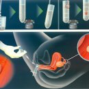 인공수정과 시험관 차이 (, 안좋은점, 성공률 등) 이미지