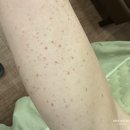 골든한의원 | 자반증한의원, 16년 치료한 한의사가 말하는 3개월의 골든타임