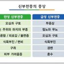 콩팥에 좋은 음식과 콩팥이 안좋을때 증상들 이미지