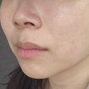 이편한크리닝샾 | 은평구 북가좌동피부샾 올가드림뷰티 가재울뉴타운점 메디컬재생 속건조관리 후기