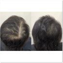 투피에스 | 목동두피문신 자연스럽게 잘하는 곳 네일샵에스 아를솔즈