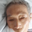 22년 8월 25일(맑음:목)아내 운명하다 처형과 임종하다 이미지