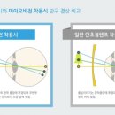 엠씨렌즈 이미지