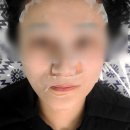 경기 광주 태전동 피부관리 샵 &#34;하이글림&#34; 기미 잡티 관리 화이트닝 후기
