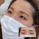 리메이드 | 안양 눈썹문신 자연스러운 리메이드 안양본점 후기