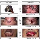 요즘 담배 왜 이렇게 징그러워졌어?? (사진주의) 이미지