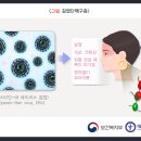 감염성 단핵구-증의 원인과 증상 이미지