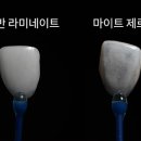 아이디치과기공소 이미지