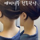 울산 달동 웨딩촬영전 맨들왁싱에서 예쁘게 준비하신 예비신부님 후기 (뒷목왁싱 헤어라인왁싱 스킨플래닝)