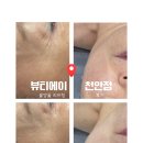 뷰티에이 | 불당동피부관리 뷰티에이천안점 물방울리프팅 혼주피부관리 후기