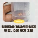 서울의원 | 땡큐서울의원 악하선 타석증 침샘결석 수술 후기