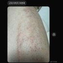 지에스25 뉴종암본점 | 강남역 ABC마트 7층 피부과 제모 시술 환불 후기