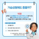 셀루션 티스토리