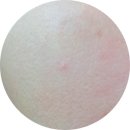 큐어시스 이미지