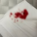 부산본병원 | 부산치질병원 결국 다녀온 후기