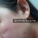 인셀덤진천점 | 인셀덤 / 인셀덤후기 / 인셀덤화장품 / 인셀덤풀세트 / 2주간의리뷰 / 찐후기 / 인셀덤청주 / 인셀덤진천