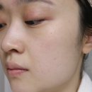 프린스테라피 이미지