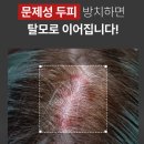 두피 브러쉬 앰플 써보고 느낀 점 솔직후기 :) 요즘 두피관리 진짜 중요하더라구요