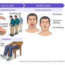 항정신병 약물 복용 환자의 대사증후군 관리 이미지