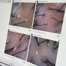 예신반석점 | 대전두피관리 예신관리 헤드스파K 대전반석점 자세한 후기