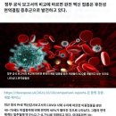 중복 백신 접종은 후천성면역결핍증후군(AIDS)으로 발전하고 있다! 이미지