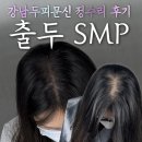 강남두피문신 출두 SMP 정수리 채운 충격적 후기