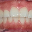 진플란트치과의원 이미지