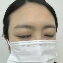 채움남성의원 | 광교 라브로우 네일 눈썹잔흔커버 헤어스트록 내돈내산 후기