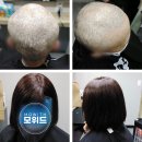 모위드