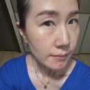 잡티앰플 추천, 엑소머 셀리노바 속기미앰플로 기미고민 홈케어 후기
