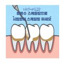 수색역 임플란트 전문 치과 잘하는 곳 추천 List 6곳