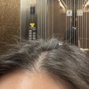 아벨리안영남대학교 | 정수리 볼륨이 고민이라 다녀온 동탄 탈모관리 아벨리 동탄점 후기
