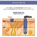 엔블리 | 피부기기 엔블리 갈바닉 사용 후기