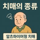 더루이체 이미지
