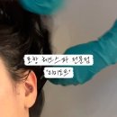 리미도트 네이버블로그