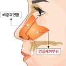 [코성형]남자 같아보이는 코, 마녀같은 코, 매부리코, 메부리코? 이미지