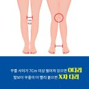 등발 이미지