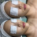 한독철물 - 군포시 산본로323번길 23 | [리뷰] 수원 영통 피부관리, 물광관리_베릴에스테틱(BERYL AESTHETIC)ෆ