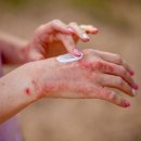 둔산한의원 이미지