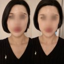 동안비결Beauty | 에스테틱 토탈뷰티샵 <리디아뷰티>에서 하루만에 예뻐진 비결[하이푸+피코토닝+물방울리프팅 리얼체험기]