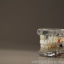 인치과의원 네이버블로그