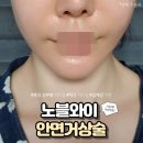 더노블성형외과의원 이미지