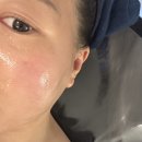 4471 | 천안 두정동 에버림 플래티넘플라필, 물광스킨부스터 후기 주차 피부관리 천안에스테틱 추천