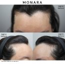 모나라피부과의원 이미지