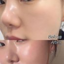 논현역 | 논현역 피부과 스킨보톡스 후기｜모공·물광 느낌은 어땠을까?